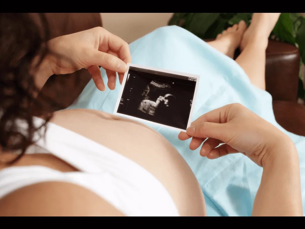 Узи по беременности 2 триместр. Узи беременности на ранних. Узи скрининг беременных 2 триместр. Узи название. На каком сроке делают первое.