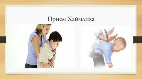 Прием геймлиха детям старше года