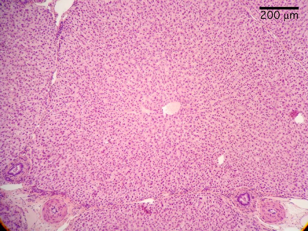 Печень свиньи гистология препарат. Печень свиньи гистология. Гистопрепарат печень свиньи. Печень человека гистология препарат. Гистологическое строение печени свиньи.