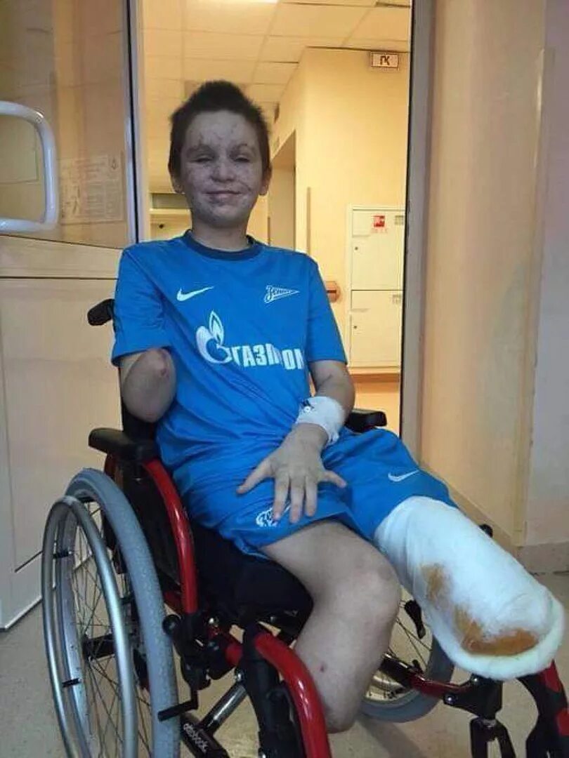 Сломали инвалиду