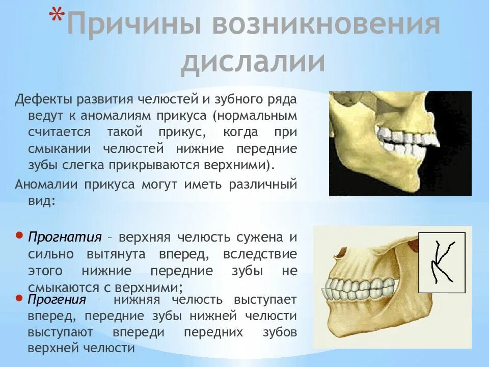 Дислалия это простыми словами. Полиморфная функциональная дислалия. Дефекты механической дислалии. Механическая дислалия примеры. Артикуляционная дислалия