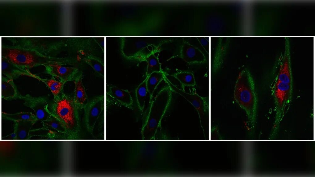 Reversed cell