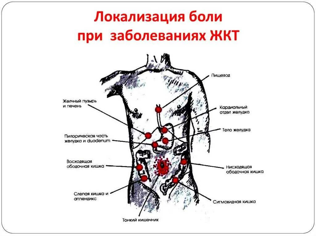 Заболевания локализация боли. Локализация боли при болезнях ЖКТ. Локализация боли в кишечнике. Локализация боли при заболеваниях желудка. Локализация боли в спине.