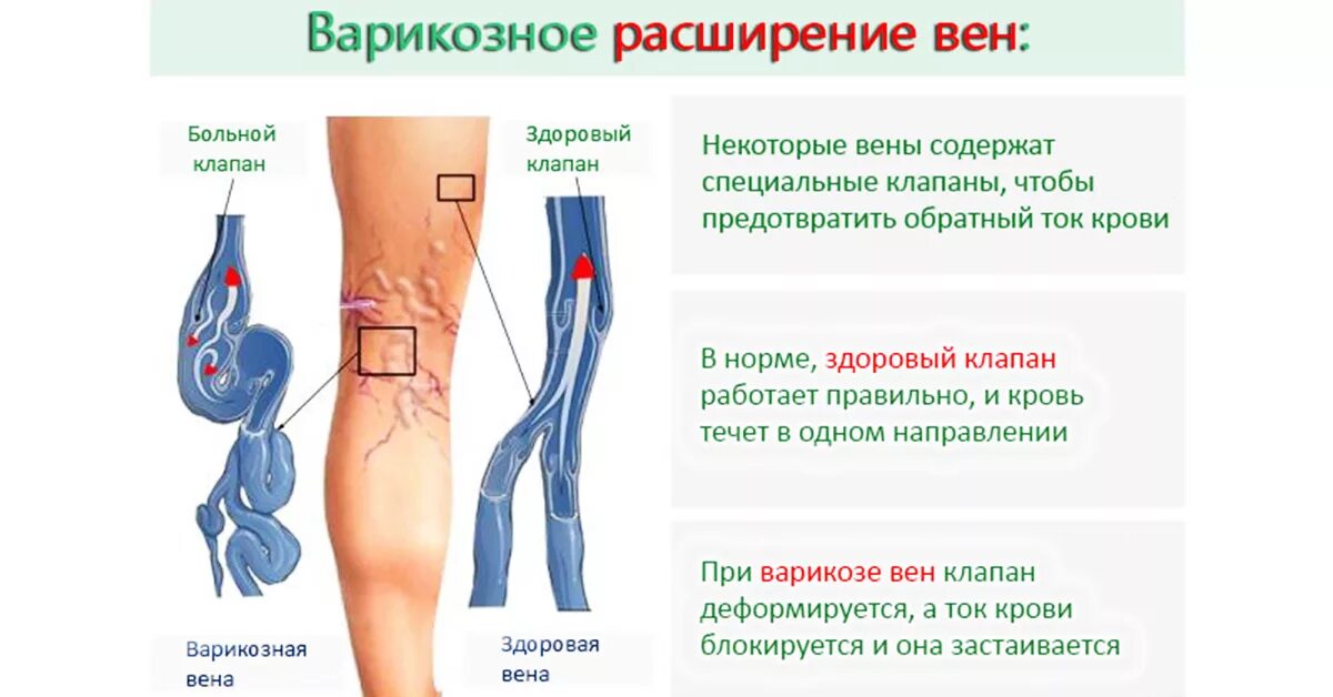 Как понять что проблемы с сосудами