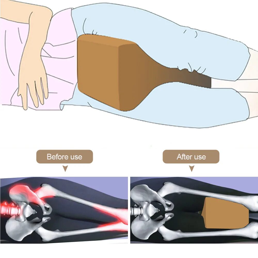 Подушка для тазобедренного сустава. Ортопедическая подушка для тазобедренного сустава. Подушка между ног для сна. Послеоперационная подушка для ног.