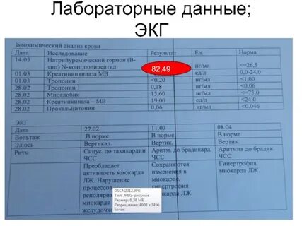 Прокальцитонин норма