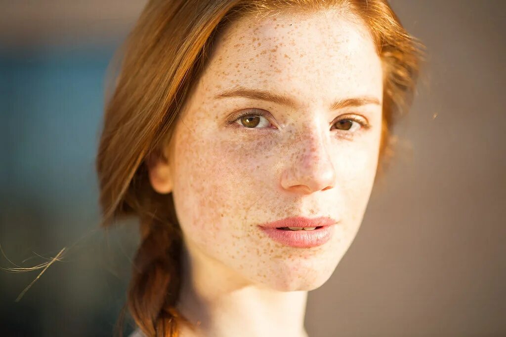 Freckles girl