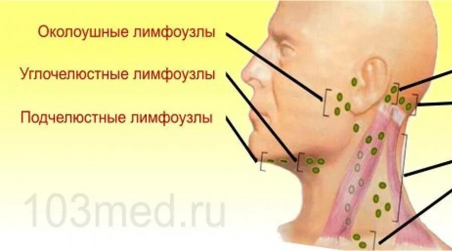 Лимфоузлы на ощупь. Лимфоузлы околоушные схема. Схема расположения лимфатических узлов на шее. Воспаленные лимфоузлы подчелюстной лимфоузел.