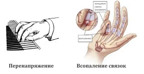 Удаление кисти