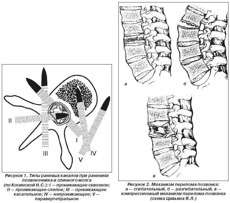 транспортировка при переломе основания черепа. методы исследования черепа. открытые травмы черепа. травмы черепа неотложная помощь. повреждение костей черепа.