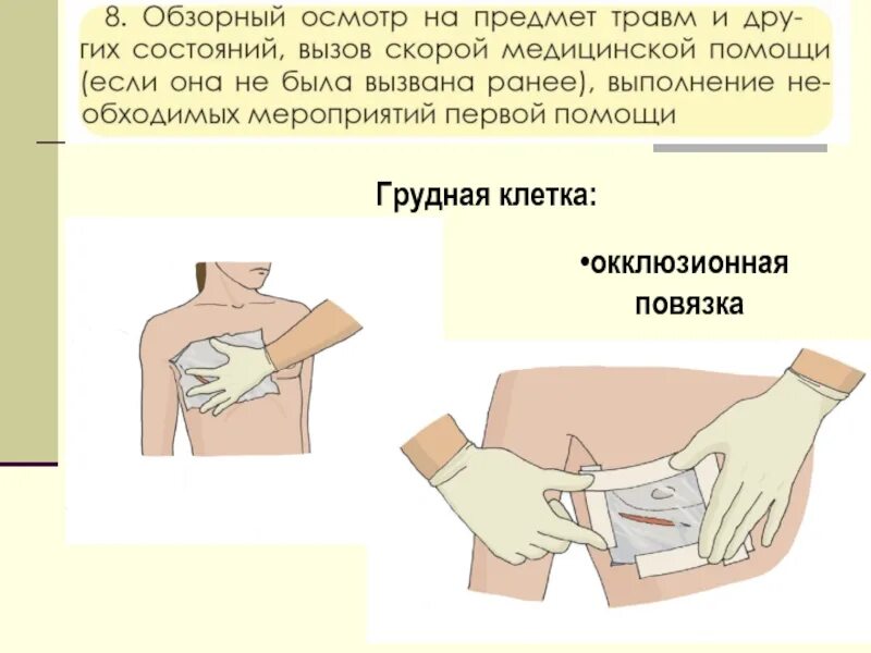 Наложение окклюзионной повязки при пневмотораксе. Наложение окклюзионной повязки. Герметичная окклюзионная повязка. Налоение экклюхионной аоаязки.