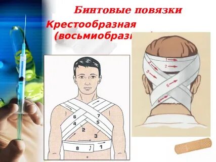 Повязки пам