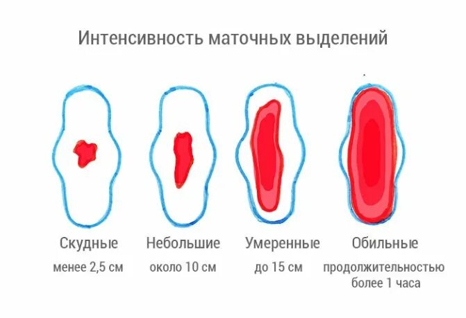 Сколько крови у беременных. Месячные по интенсивности. Месячные норма. Скудные умеренные обильные месячные.