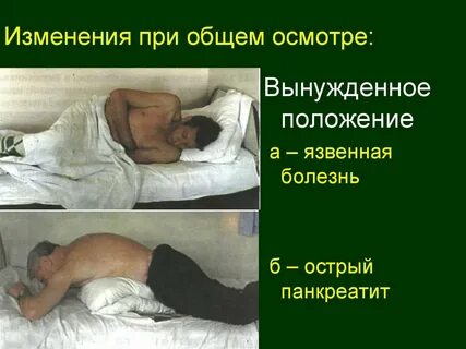 Позу эмбриона пациент принимает при