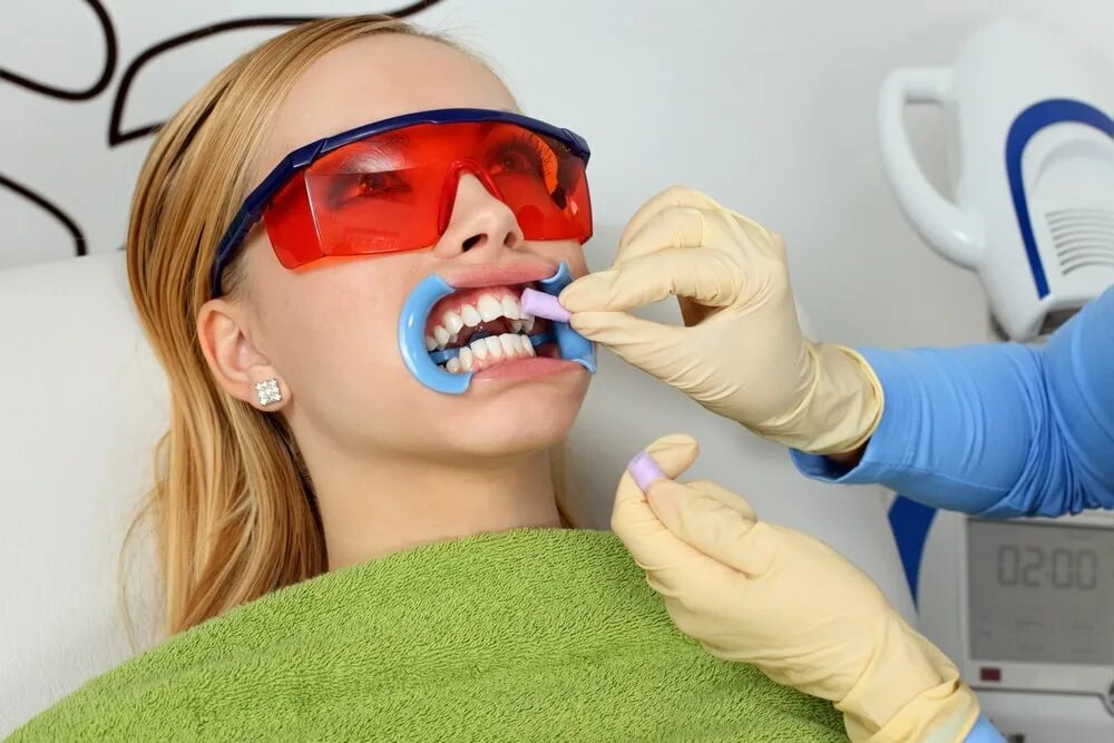 Перед отбеливанием. Химическое отбеливание зубов. Отбеливание зубов в стоматологии. Офисное отбеливание зубов.