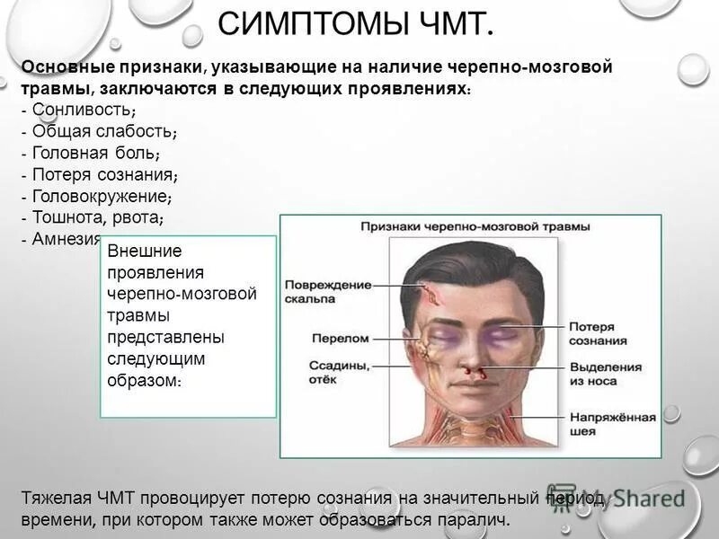 Открытая травма мозга. Клинические проявления ЧМТ. Признаки черепно-мозговой травмы. Черепно-мозговая травма симптомы. Симптомы при черепно мозговой травме.