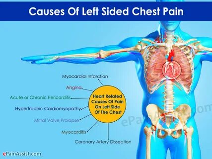 Stabbing Pain In The Left Side Of Chest.