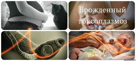 Токсоплазмоз симптомы фото