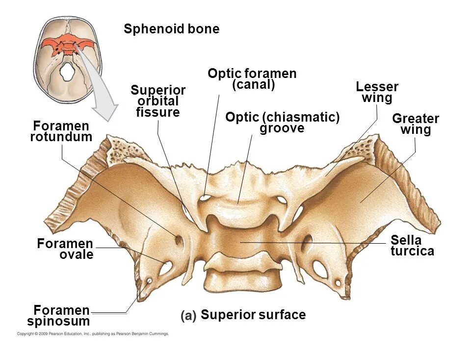 Турецкие седло кость. Клиновидная кость кости. Клиновидная кость остистое отверстие. Клиновидная кость аксиальные срезы. Анатомия костей черепа клиновидная кость.