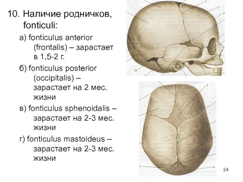 9 родничков. Роднички черепа анатомия. Швы и роднички черепа анатомия. Роднички черепа новорожденного. Топография черепа роднички.