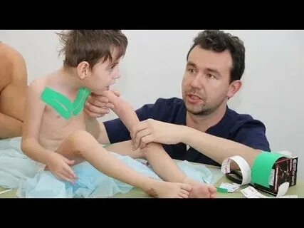 Спастичность при дцп