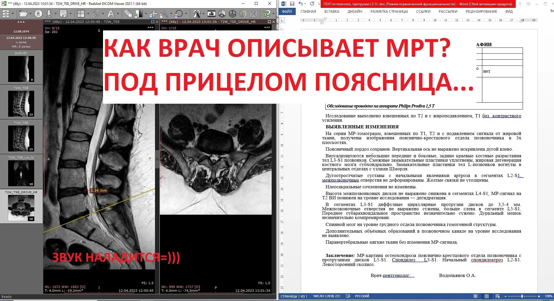 Мрт пояснично крестцового отдела сколько по времени. Мрт пояснично крестцового отдела сколько по времени