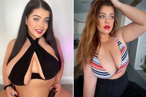 Imogen Grace has one breast that is about double the size of the other. 