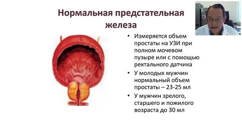 Плохая предстательная железа