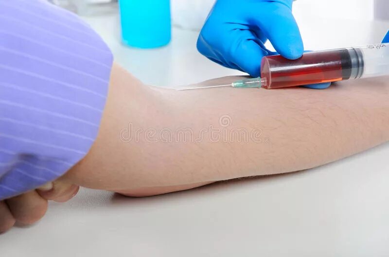 Уколы. Горячий укол. Горячий укол от алкоголизма. Горячий укол хлористый кальций. Кальций хлор внутримышечно.