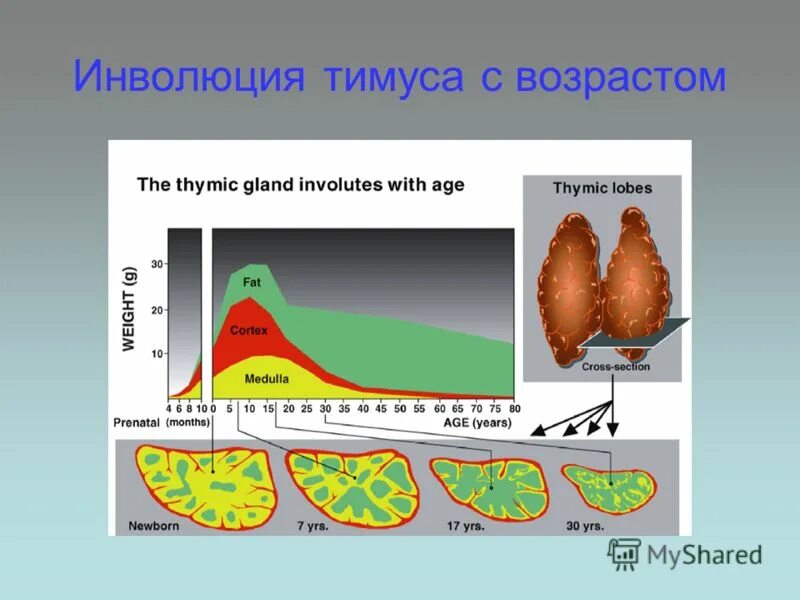инволюция тимуса. инволюция тимуса. неполная инволюция. неполная инволюция. инволюция тимуса.