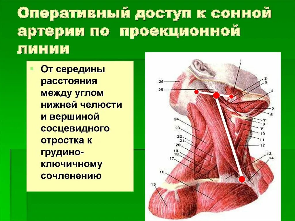 Топографическая анатомия шеи презентация. Топография области шеи. Грудино-ключично-сосцевидная артерия. Топография сонной артерии. Где находится общая сонная артерия