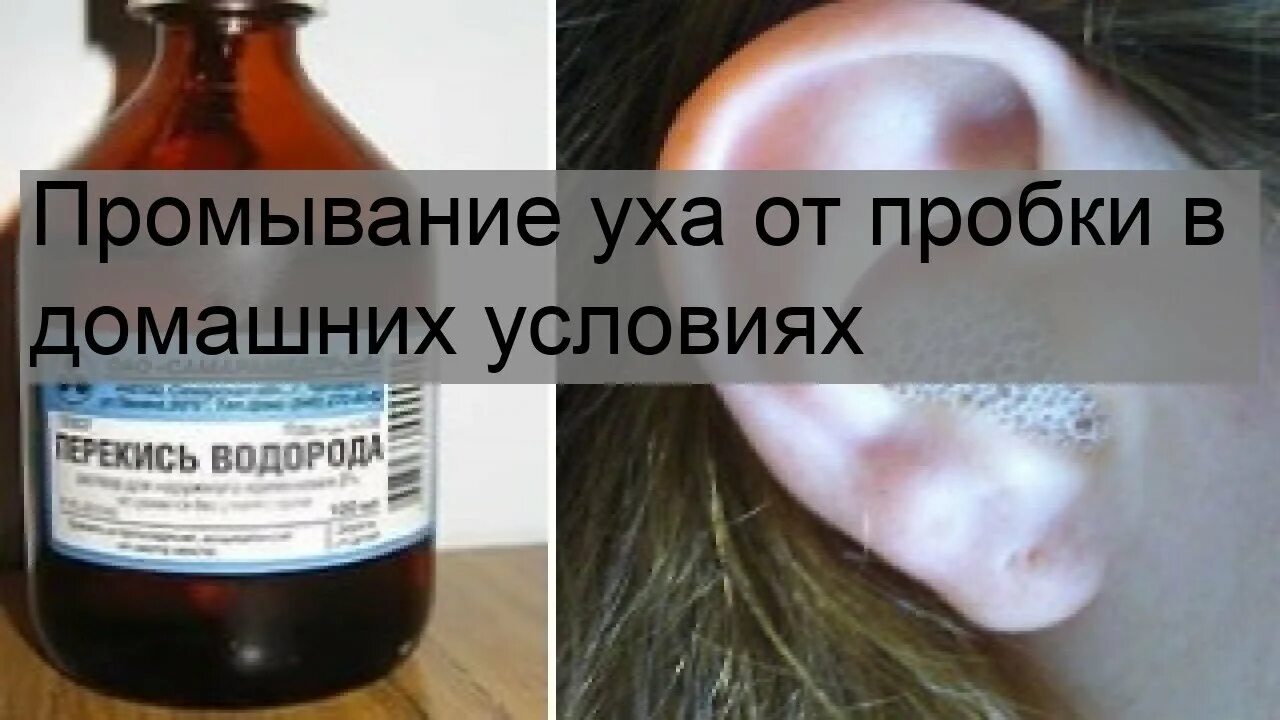 Закапать ухо перекись сколько. Промывание пробок в ушах домашних условиях. Как промыть ухо в домашних условиях. Промывание уха в домашних условиях.