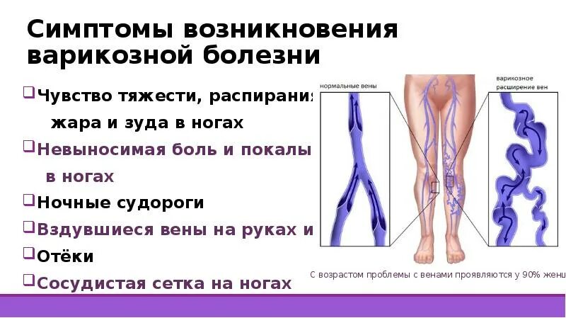 Чувство тяжести в ногах. Причины возникновения варикозной болезни. Покалывание вен на ногах. Ощущение распирания в ногах. Тяжесть в ногах вены