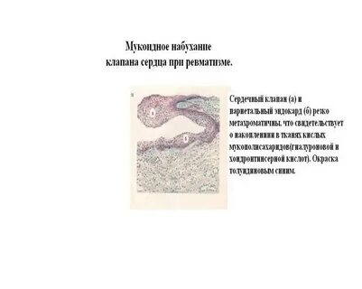 Мукоидное набухание это