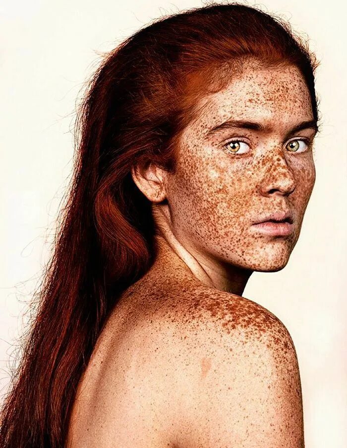 Freckles перевод. Модели с веснушками. Фотомодель с веснушками.