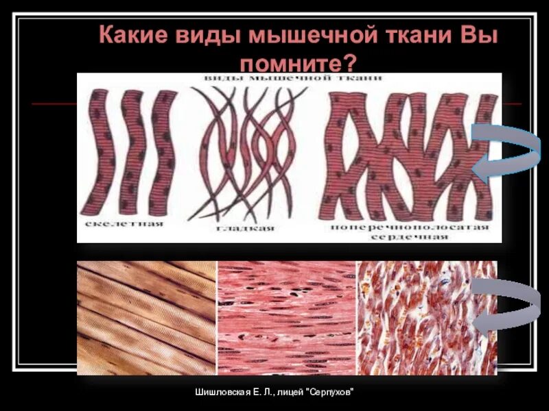 4 типа мышечной ткани. Разновидности мышечной ткани. виды мышечной ткани человека. виды мышечной ткани рисунок. мышечная ткань человека рисунок.