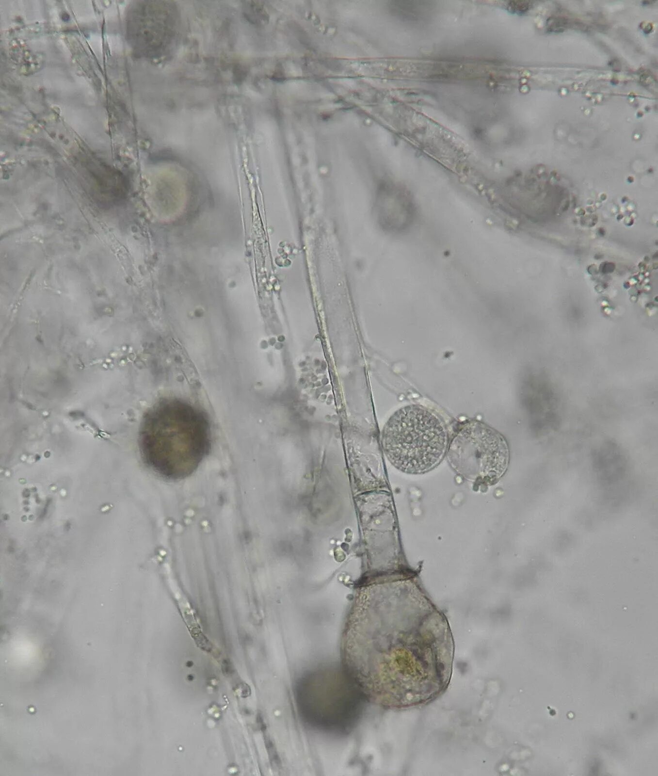 Mucor микробиология. Мучнистая роса в микроскоп. Плесневые грибы mucor. Гриб mucor racemosus. Мукор и ризопус.