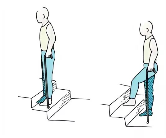 Как подниматься по лестнице после эндопротезирования. Лестница костыли. Ходьба по ступенькам с тростью. Ходьба на костылях по лестнице. Подъем по лестнице на костылях.