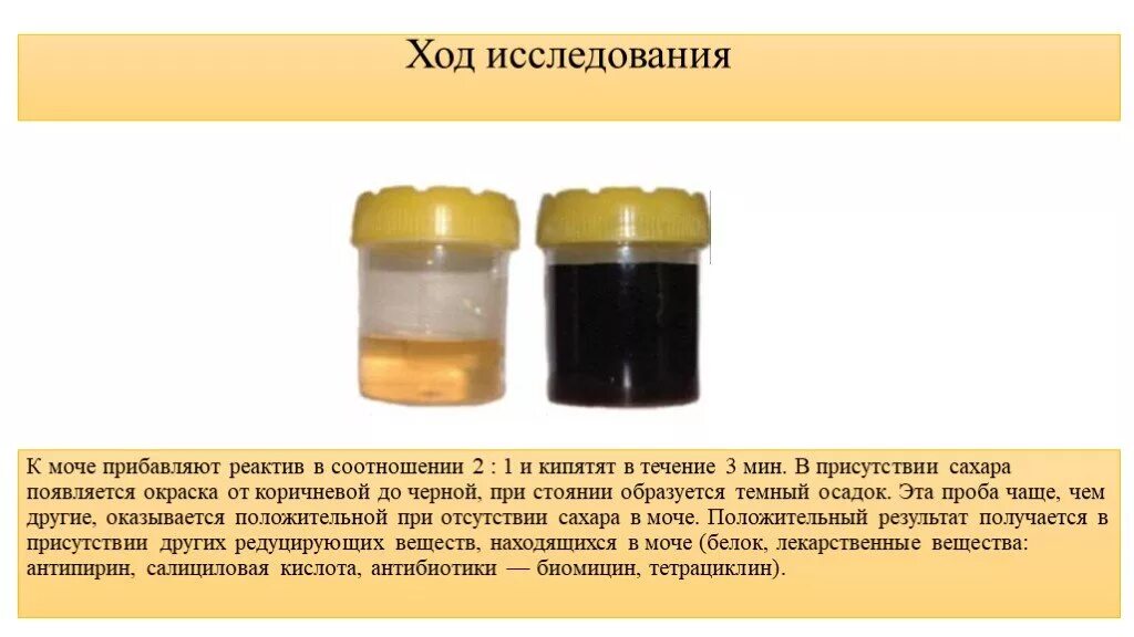 Бывшие как моча. Общий анализ мочи презентация. Обезвоживание цвету мочи. Бывшие как моча. Бывшие как моча.