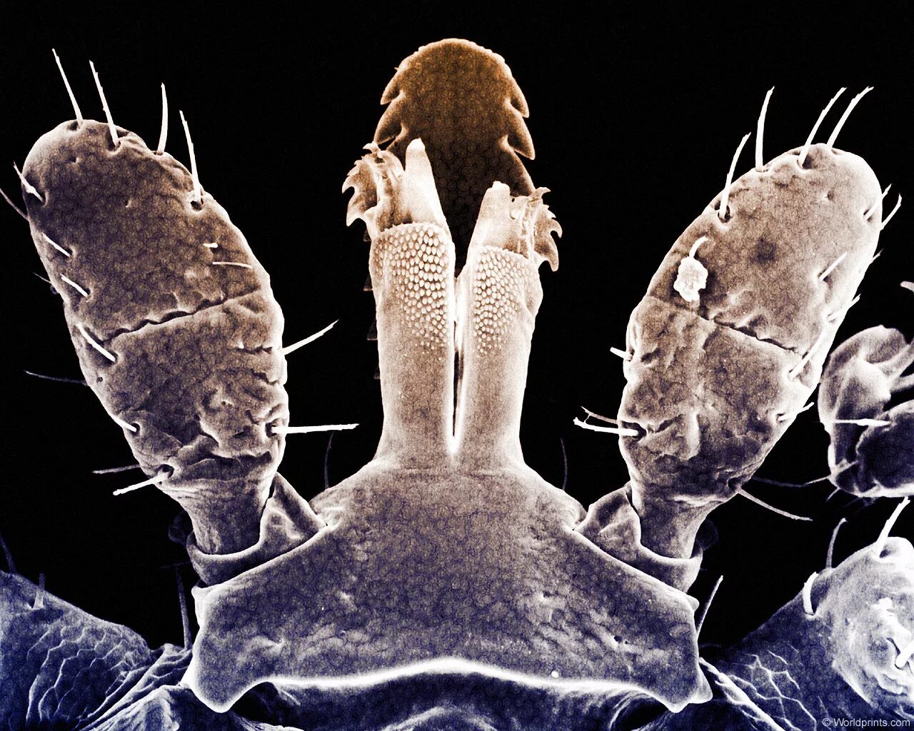 Бактерии на мухе. Микробы на руках. Микробы под микроскопом для детей.