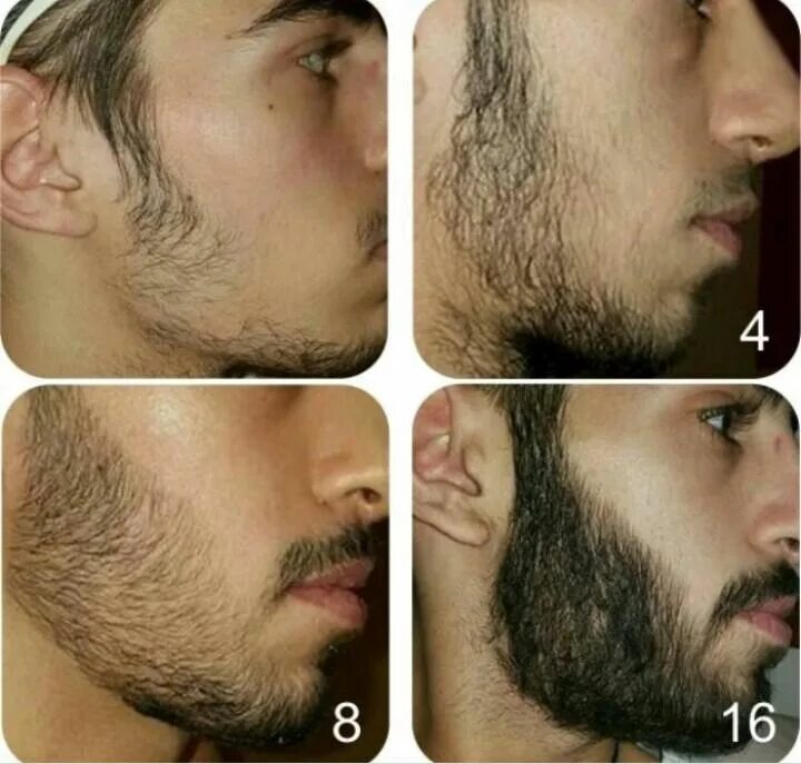 Рост волос на лице у мужчин. Активатор роста бороды миноксидил. Этапы роста бороды. Щетина стадии. Стадии отращивания бороды.