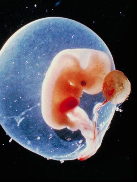 какого размера плод на 5-6 неделе беременности. эмбрион на 5 неделе беременности. эмбрион на 6 неделе беременности.