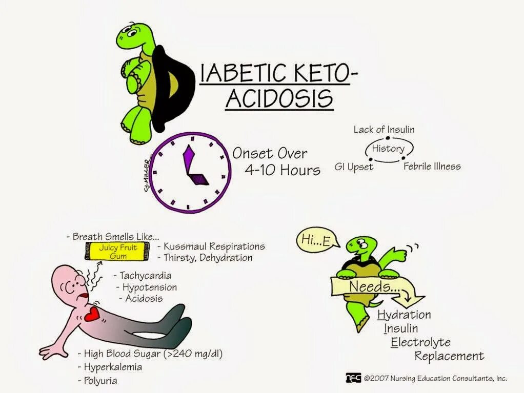 Diabetic Ketoacidosis. Hyperglycemia. Ketoacidosis coma. Третье картинка.