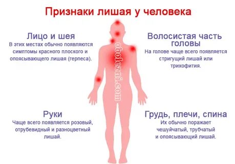 Герпес погибает при температуре