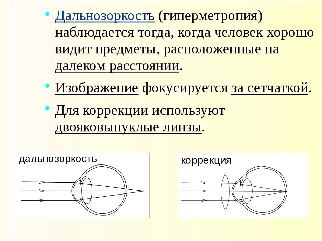 Дальнозорким людям необходимо использовать очки так как