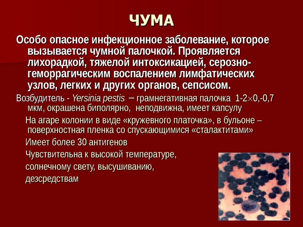 Чума является инфекцией