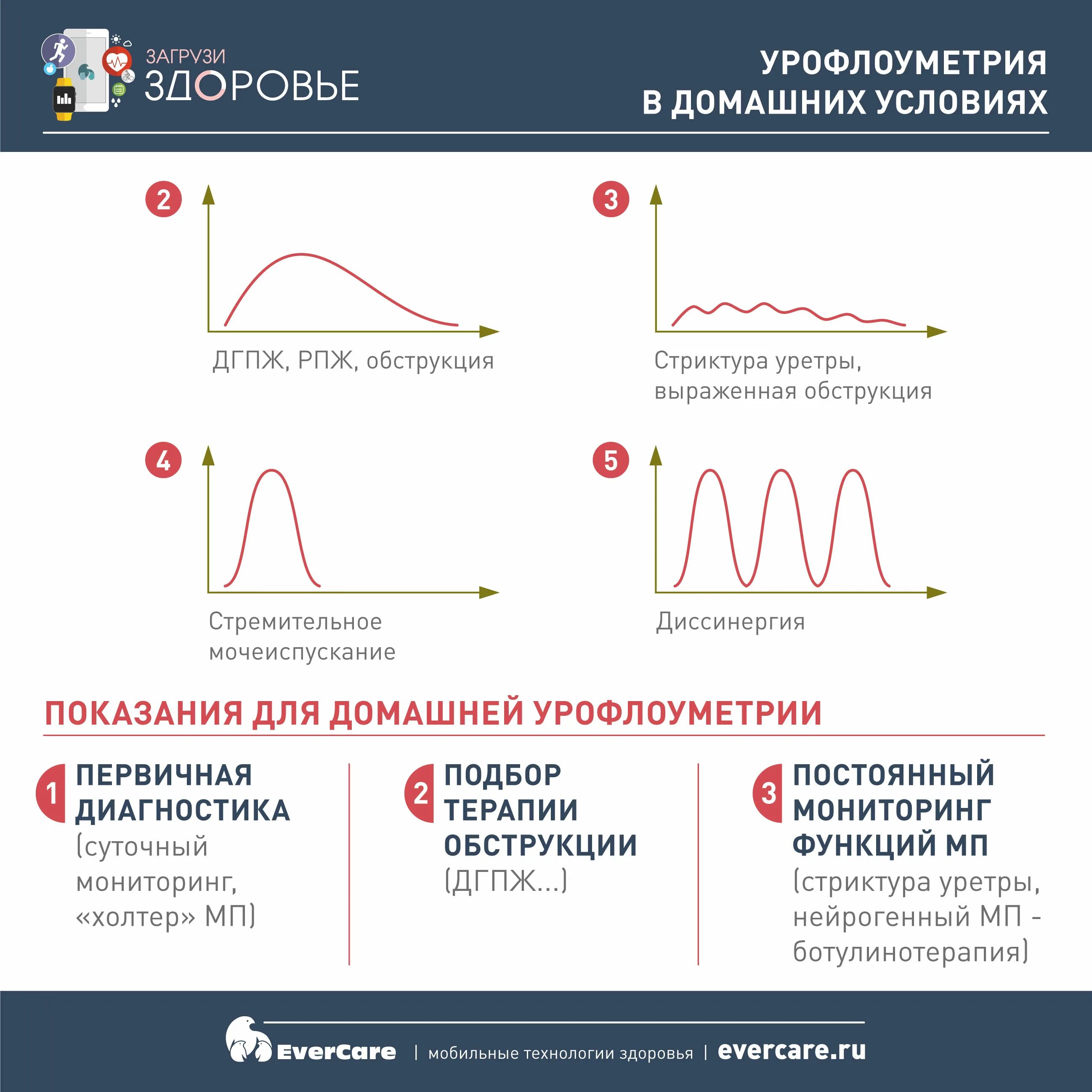 Урофлоуметрия расшифровка показателей у детей. Урофлоуметрия интерпретация результатов. Урофлоуметрия показатели нормы. Стриктура уретры урофлоуметрия.