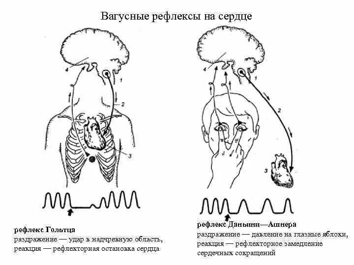 Вагусные рефлексы (гольца, Данини-Ашнера).. Рефлекторный путь рефлекса Данини-Ашнера. Рефлексы сердца физиология. Рефлекс Данини Ашнера.