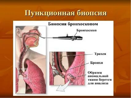 Биопсия где