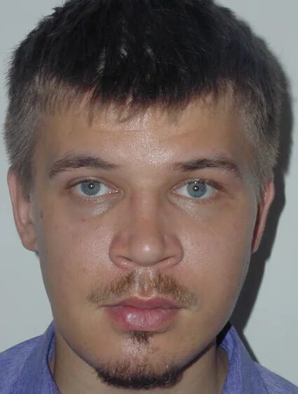 Челюстно лицевой хирург ростов на дону. Караян арутюн суренович. караян арутюн суренович хирург. караян хирург челюстно-лицевой. ковалев михаил игоревич челюстно-лицевой хирург.